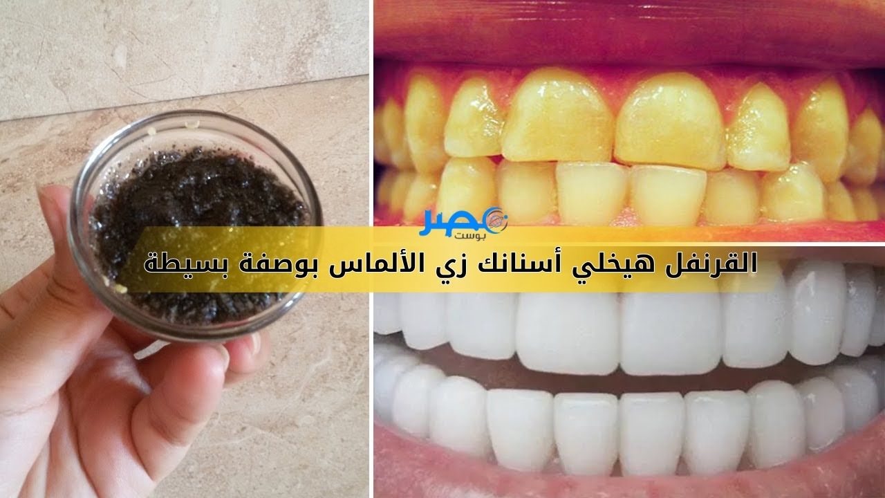 علاج رباني للأسنان..بـ5 جنيه عند العطار هتخلي سنانك زي الألماس وفي أسبوع واحد